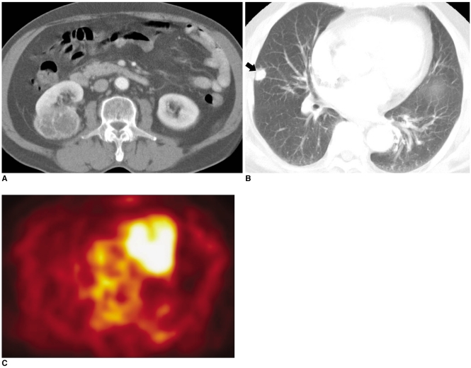 Fig. 17