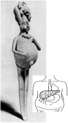 FIG 1