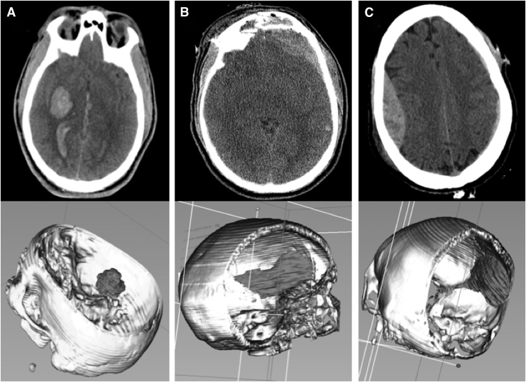 FIG. 3.