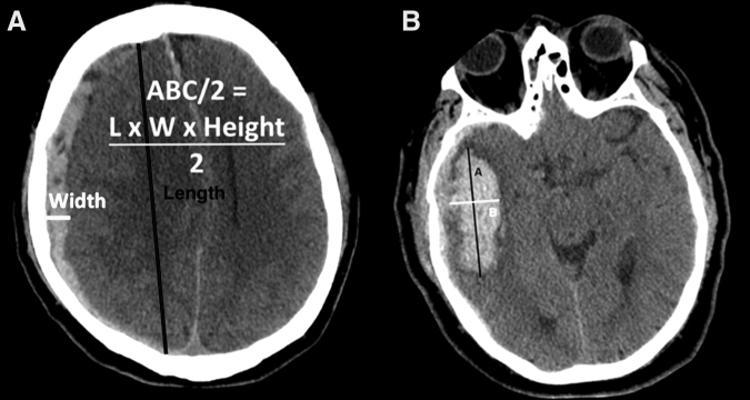 FIG. 1.