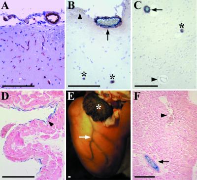 FIG. 6