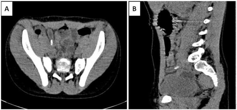 Figure 2.