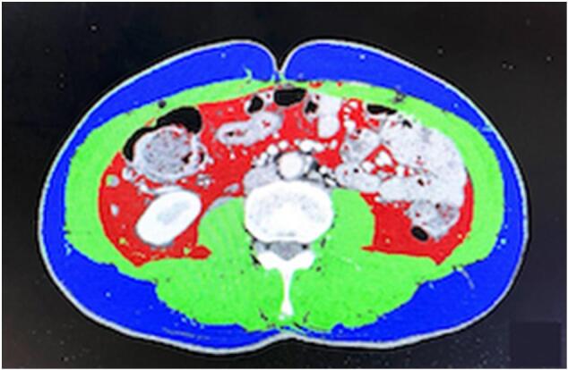 Fig. 1