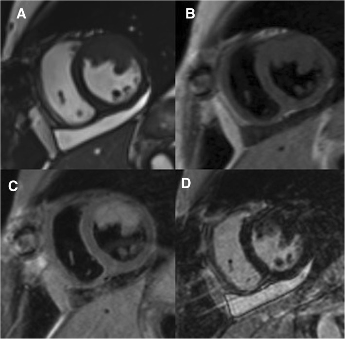 Fig. 3