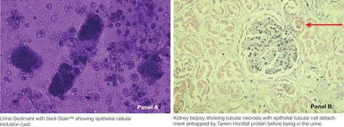 Figure 3 A and B