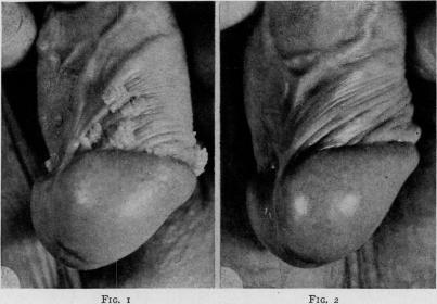 Fig. 1., Fig. 2.