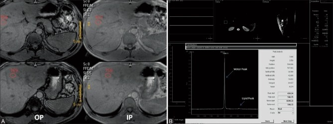 Figure 1 (A and B)