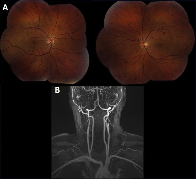 Fig. 1