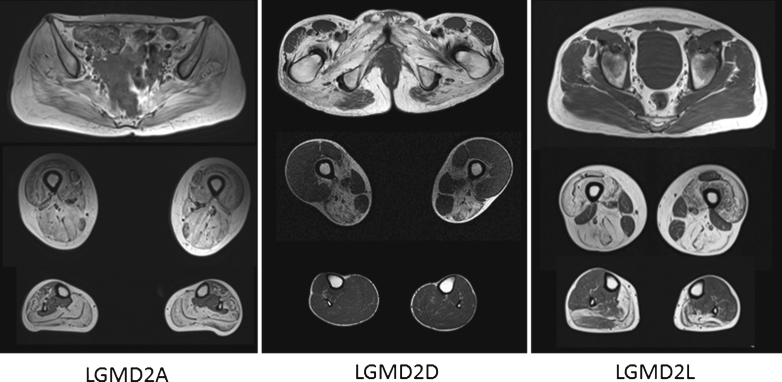 Fig.2