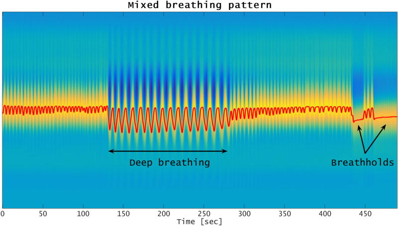 Figure 11