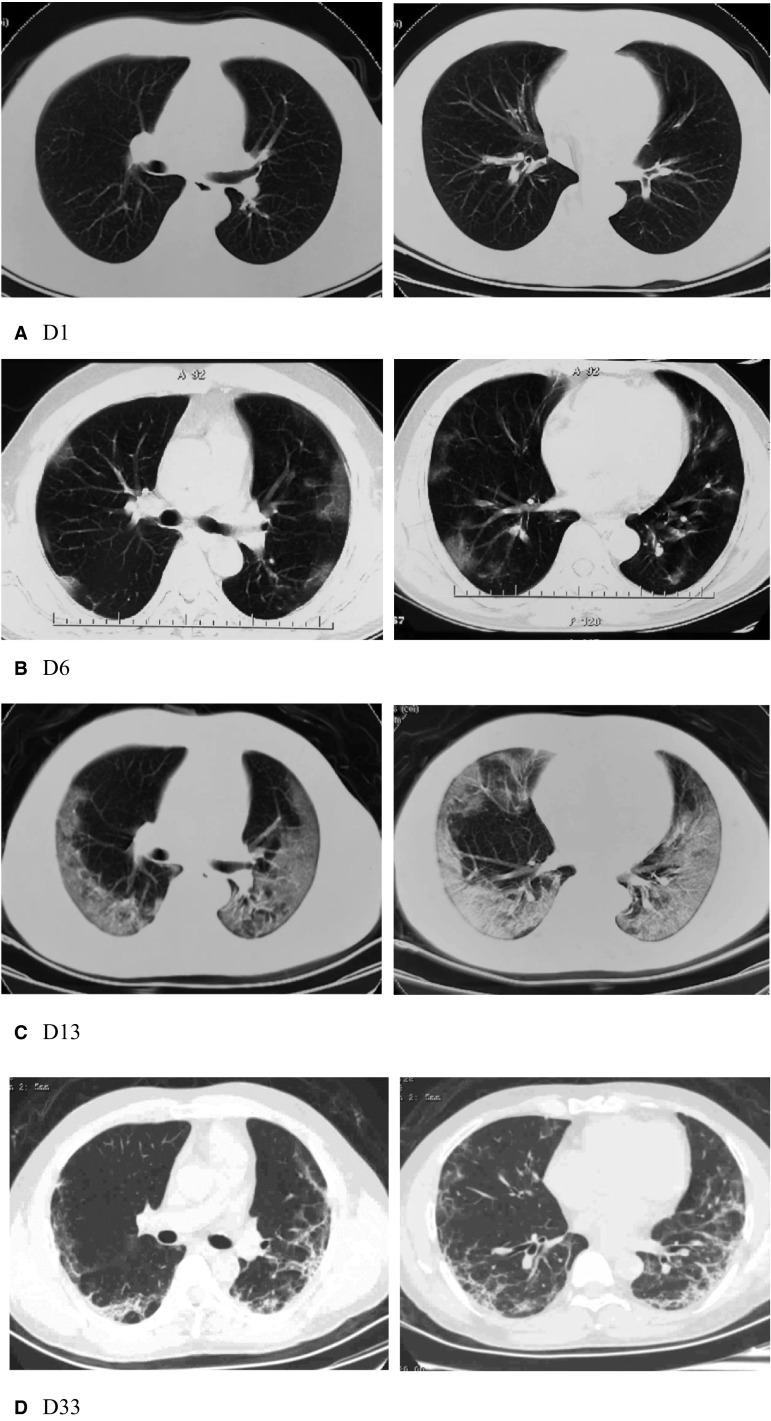 FIGURE 1