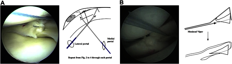 Fig 5