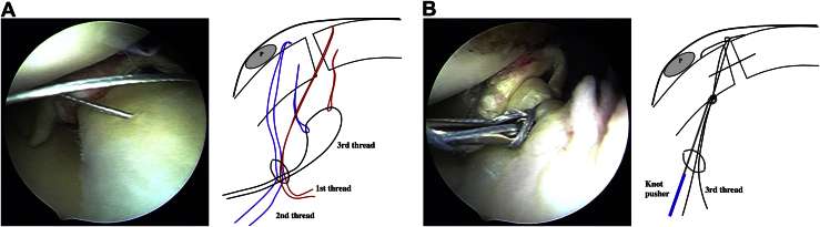 Fig 4