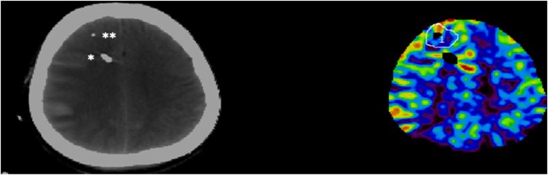 Fig. 2