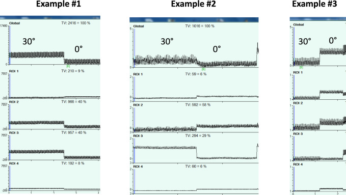 Fig. 2