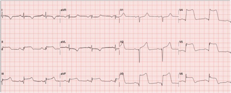 Figure 6: