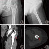 Fig. 6