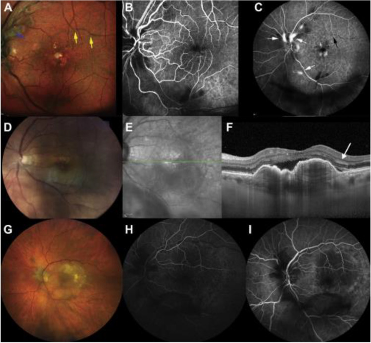 Fig. 4