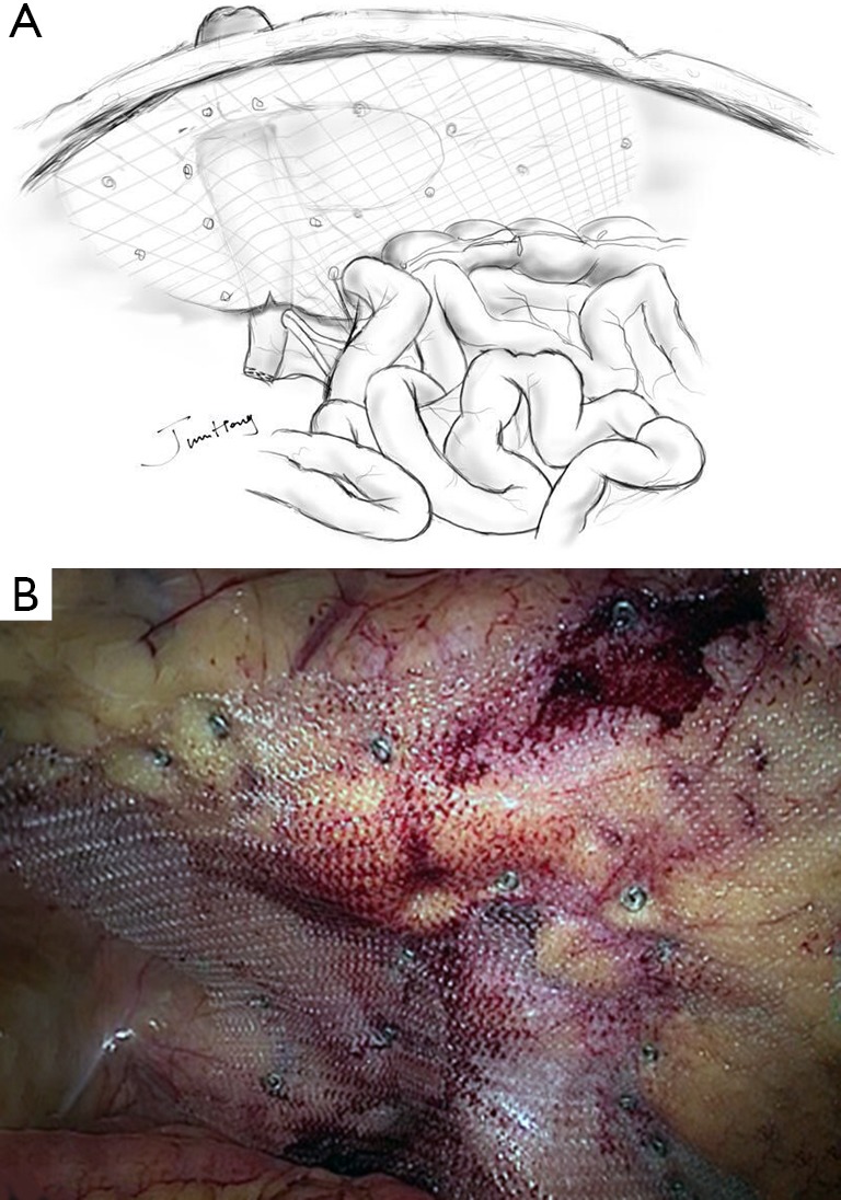 Figure 35