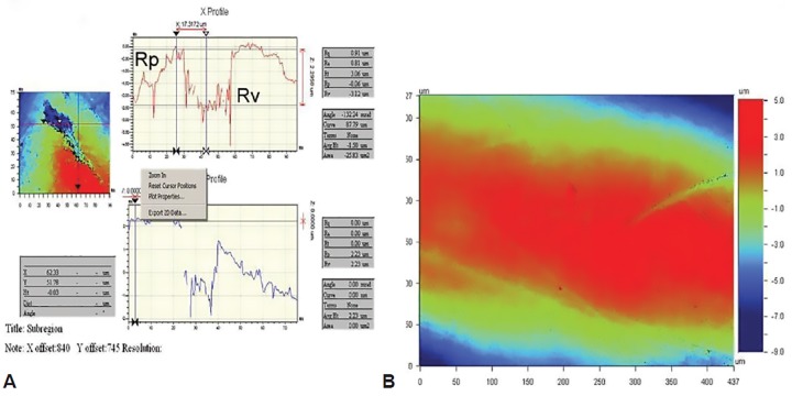 Figs 1A and B: