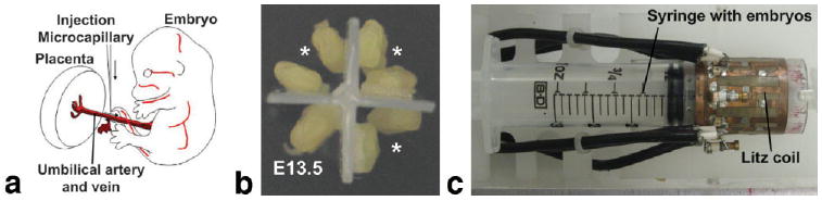 FIG. 1