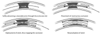 Fig. 9