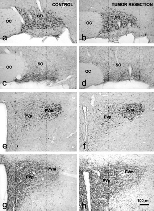 Fig. 13