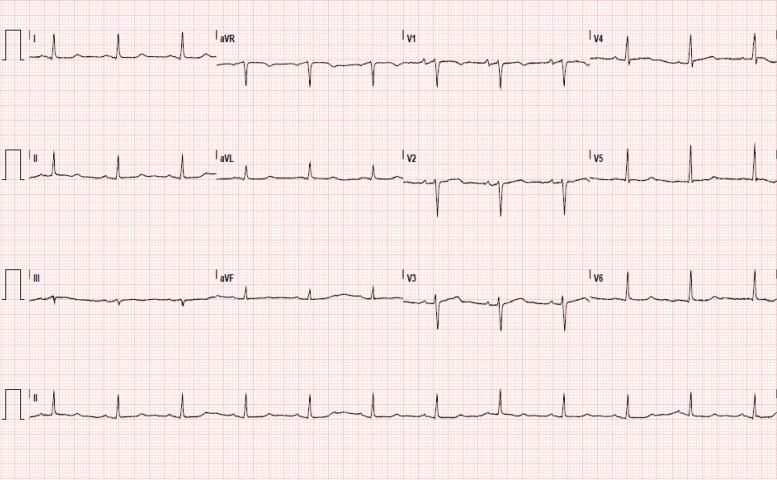 Figure 1