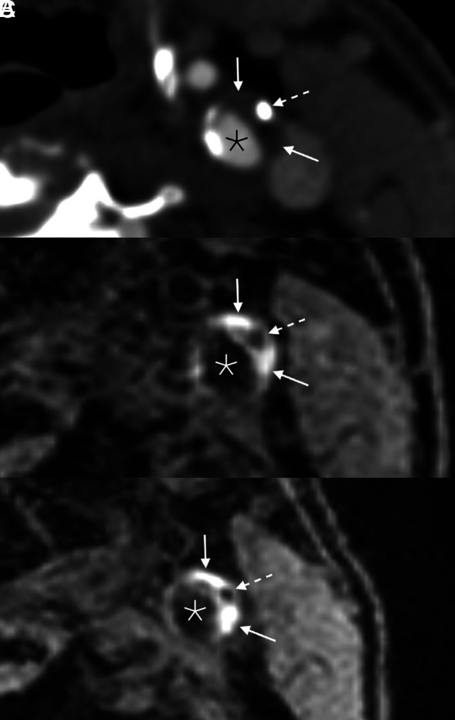 FIG 2.