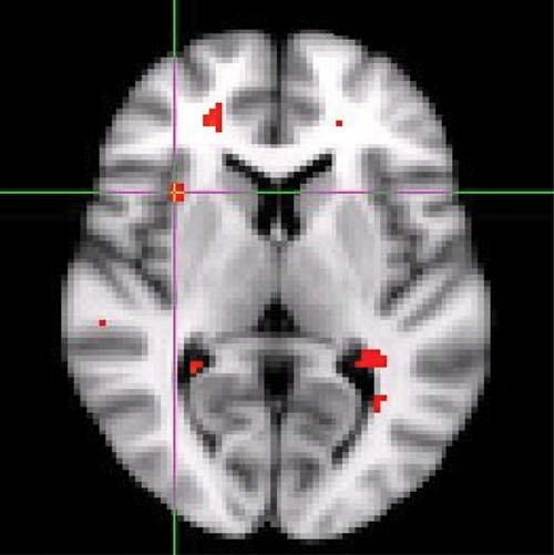 Fig. 1