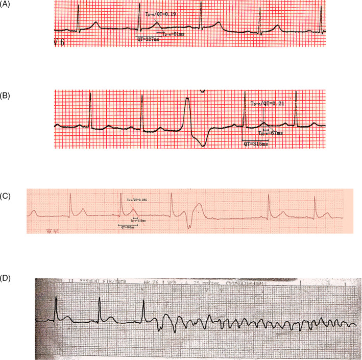 FIGURE 1