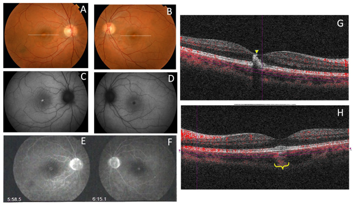 Figure 19