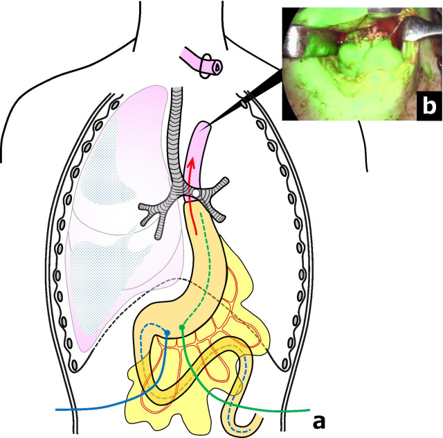 Fig. 4