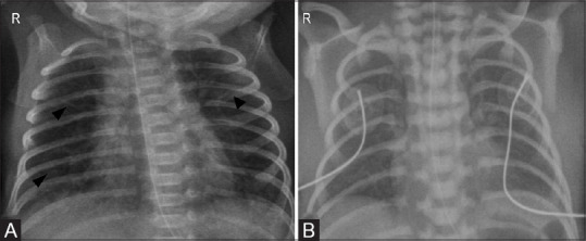 Figure 4(A and B)