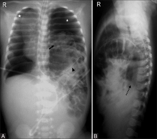 Figure 14(A and B)