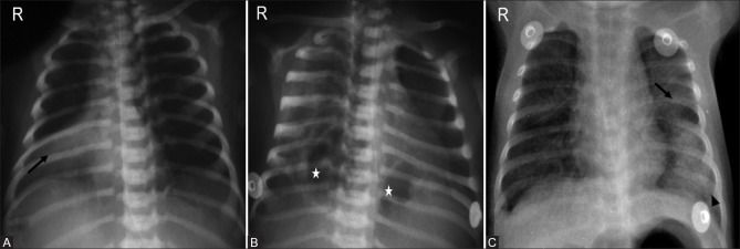 Figure 13(A-C)