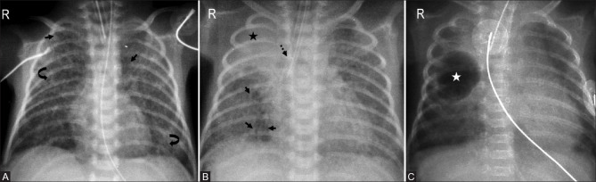 Figure 7(A-C)