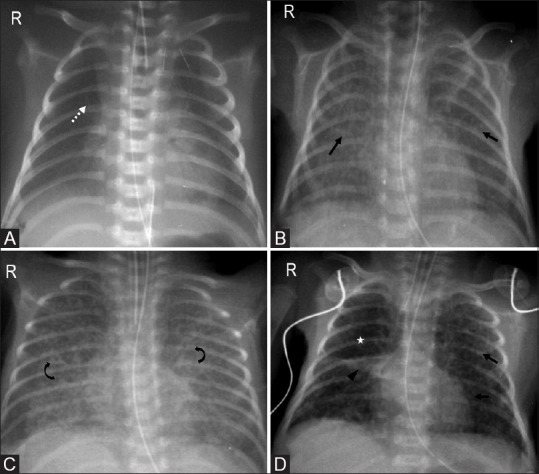 Figure 10(A-D)