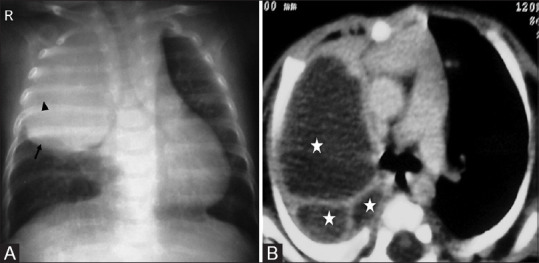 Figure 15(A and B)