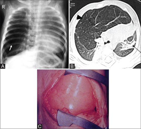 Figure 16(A-C)