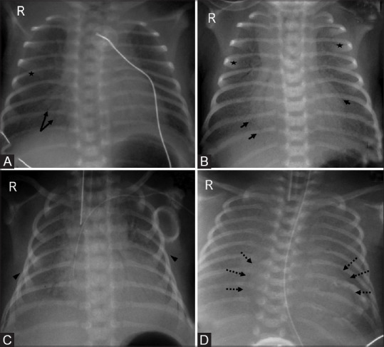 Figure 5(A-D)