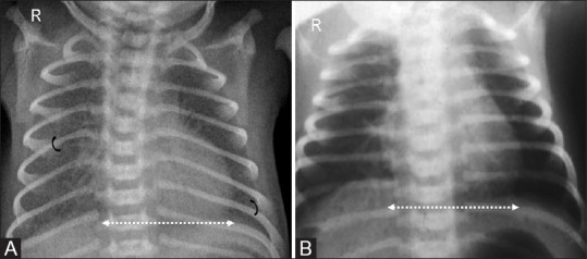 Figure 11(A and B)