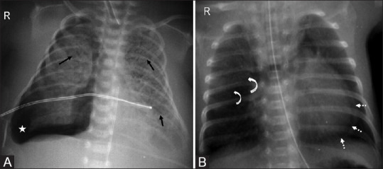 Figure 8(A and B)