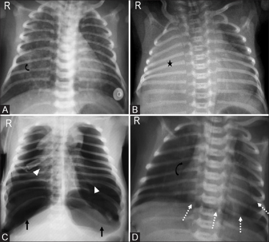 Figure 12(A-D)