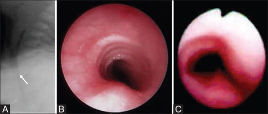 Figure 17(A-C)