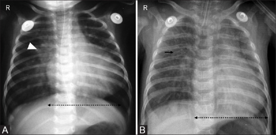 Figure 19(A and B)