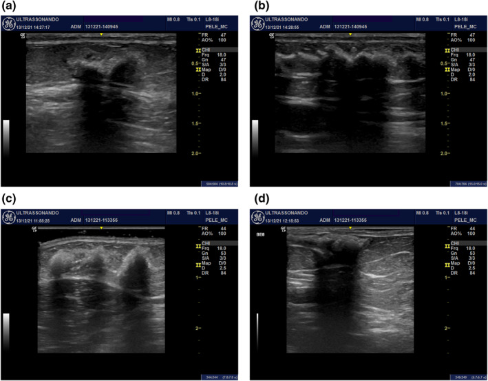 FIGURE 3