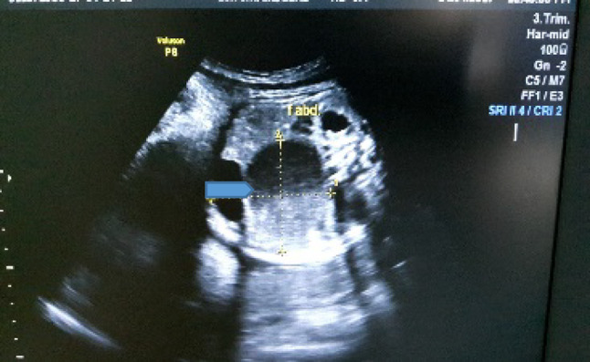 Fig. 1
