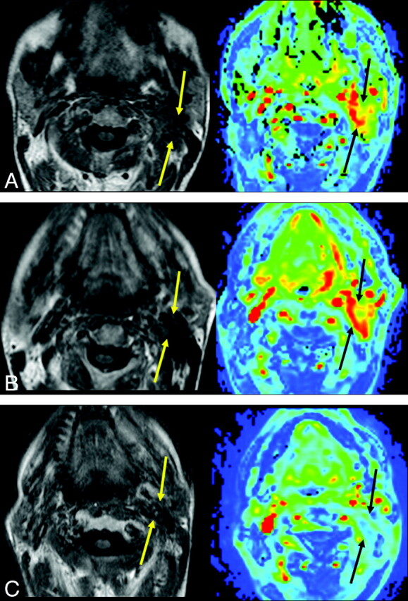 Fig 3.