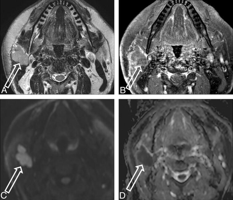 Fig 4.